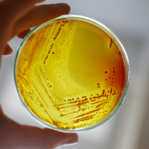 Hand holding a petri dish of antibiotic-resistant bacteria colonies growing on yellow agar