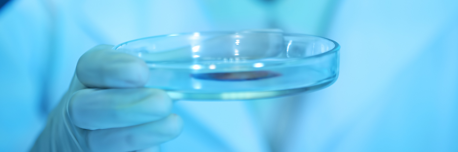 What bacteria causes UTI: gloved hand holding a petri dish culture in a lab
